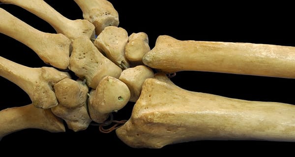 Photograph of human wrist and forearm bones